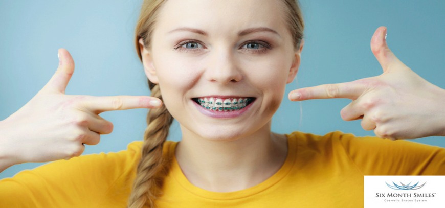 Six Month Smiles Six Month Smiles