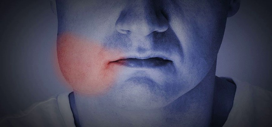 Swollen mouth Swollen Mouth