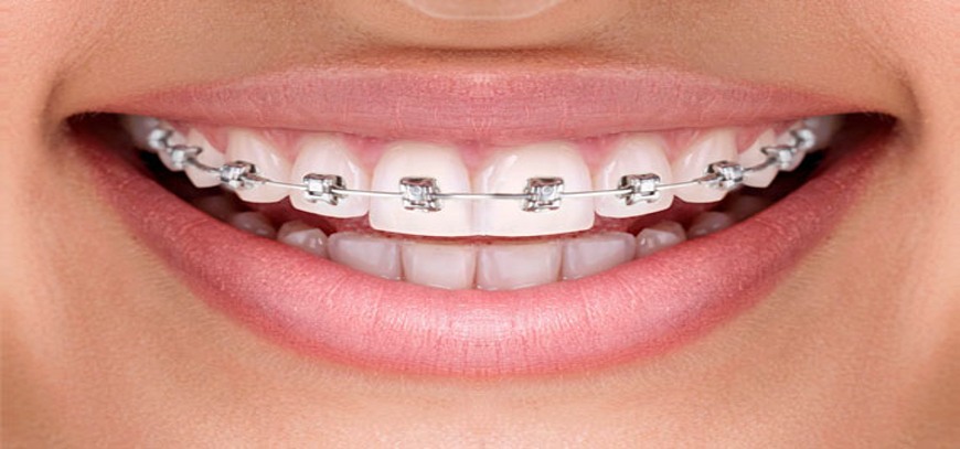 smile-8-1 Orthodontics